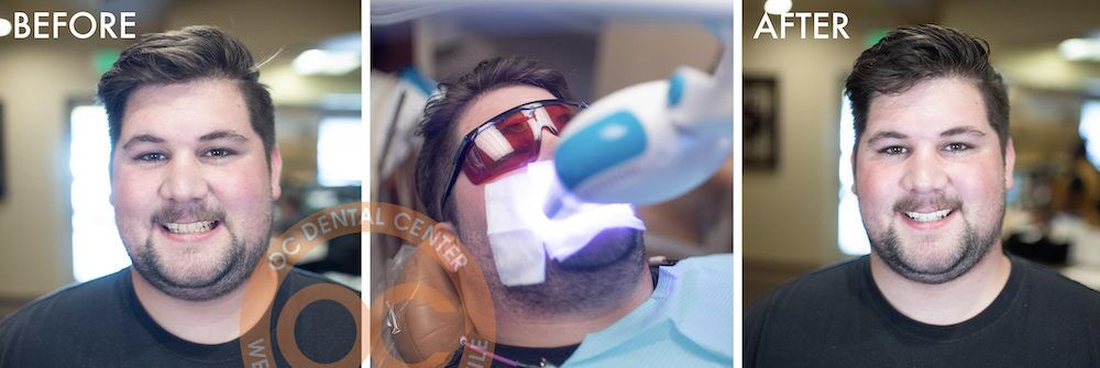 Smile Gallery - OC Dental Center