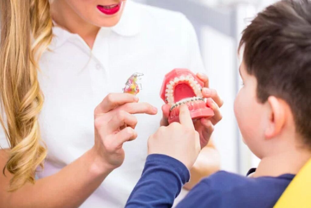 Teeth Braces – Types of Orthodontic Braces, Age Limit, Getting Dental Braces,  Food Habits