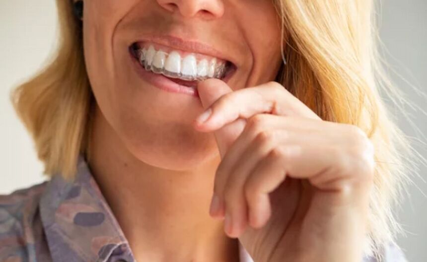 How To Fix An Overbite Without Braces - College Plaza Dental