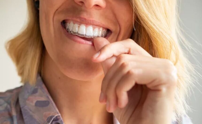 Do You Need Braces if You Have an Overbite?